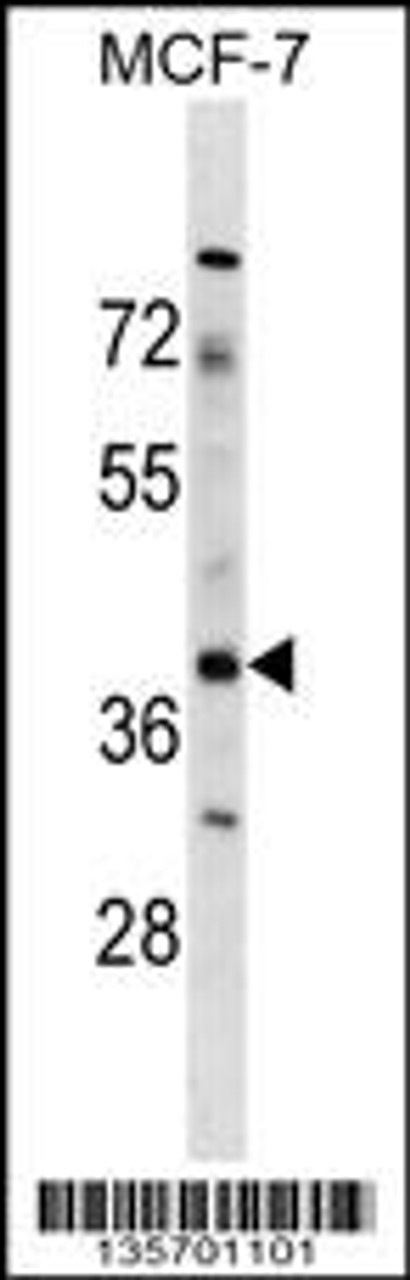 Western blot analysis in MCF-7 cell line lysates (35ug/lane) .