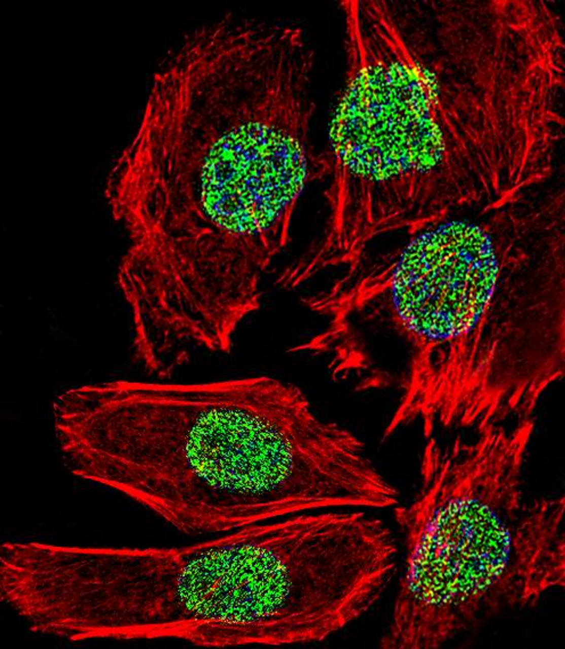 Fluorescent confocal image of A549 cell stained with FOSL2 Antibody .A549 cells were fixed with 4% PFA (20 min) , permeabilized with Triton X-100 (0.1%, 10 min) , then incubated with FOSL2 primary antibody (1:25) . For secondary antibody, Alexa Fluor 488 conjugated donkey anti-rabbit antibody (green) was used (1:400) .Cytoplasmic actin was counterstained with Alexa Fluor 555 (red) conjugated Phalloidin (7units/ml) . Nuclei were counterstained with DAPI (blue) (10 ug/ml, 10 min) . FOSL2 immunoreactivity is localized to Nucleus significantly.