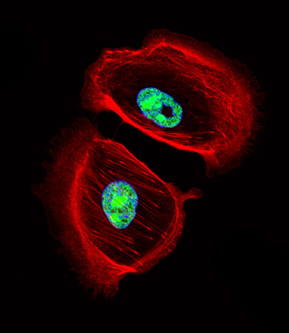 Fluorescent confocal image of SK-BR-3 cell stained with ARNT2 Antibody . SK-BR-3 cells were fixed with 4% PFA (20 min) , permeabilized with Triton X-100 (0.1%, 10 min) , then incubated with ARNT2 primary antibody (1:25) . For secondary antibody, Alexa Fluor 488 conjugated donkey anti-rabbit antibody (green) was used (1:400) .Cytoplasmic actin was counterstained with Alexa Fluor 555 (red) conjugated Phalloidin (7units/ml) . Nuclei were counterstained with DAPI (blue) (10 ug/ml, 10 min) .ARNT2 immunoreactivity is localized to nucleus significantly.