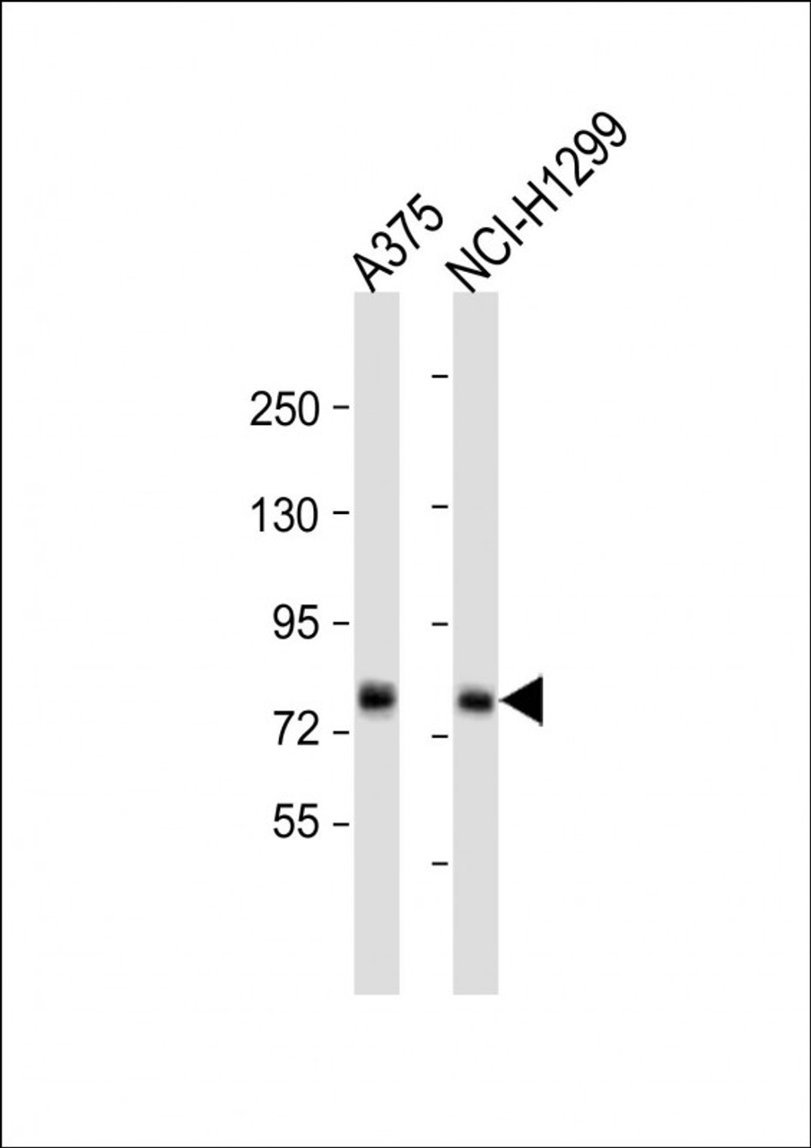 Western Blot at 1:1000 dilution Lane 1: A375 whole cell lysate Lane 2: NCI-H1299 whole cell lysate Lysates/proteins at 20 ug per lane.