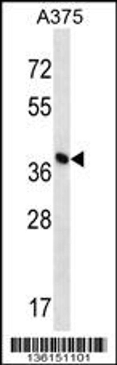 Western blot analysis in A375 cell line lysates (35ug/lane) .