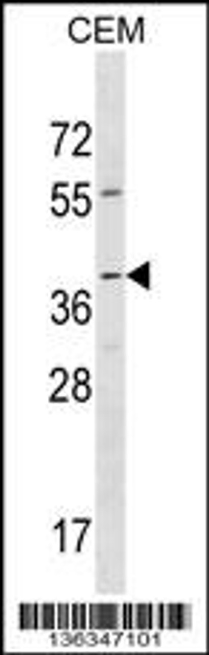 Western blot analysis in CEM cell line lysates (35ug/lane) .