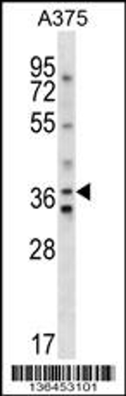 Western blot analysis in A375 cell line lysates (35ug/lane) .