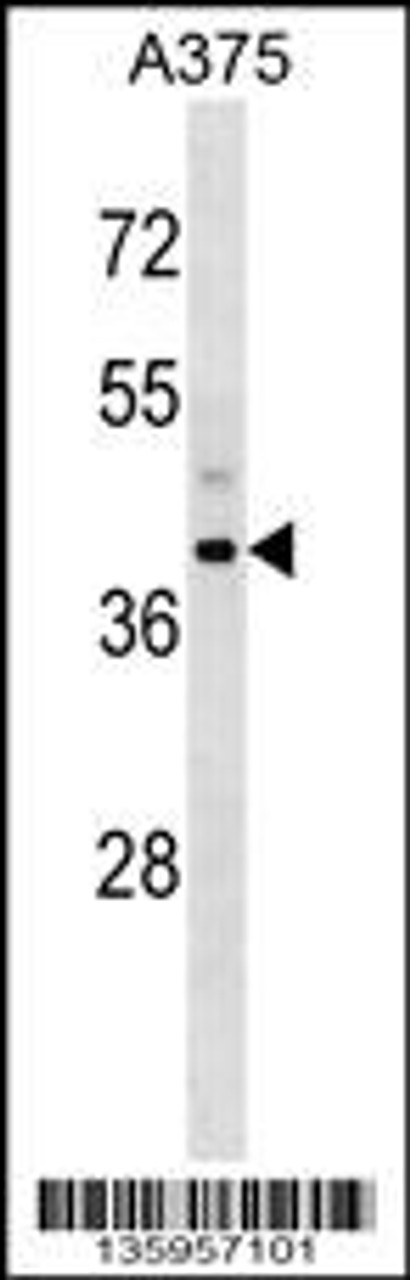 Western blot analysis in A375 cell line lysates (35ug/lane) .