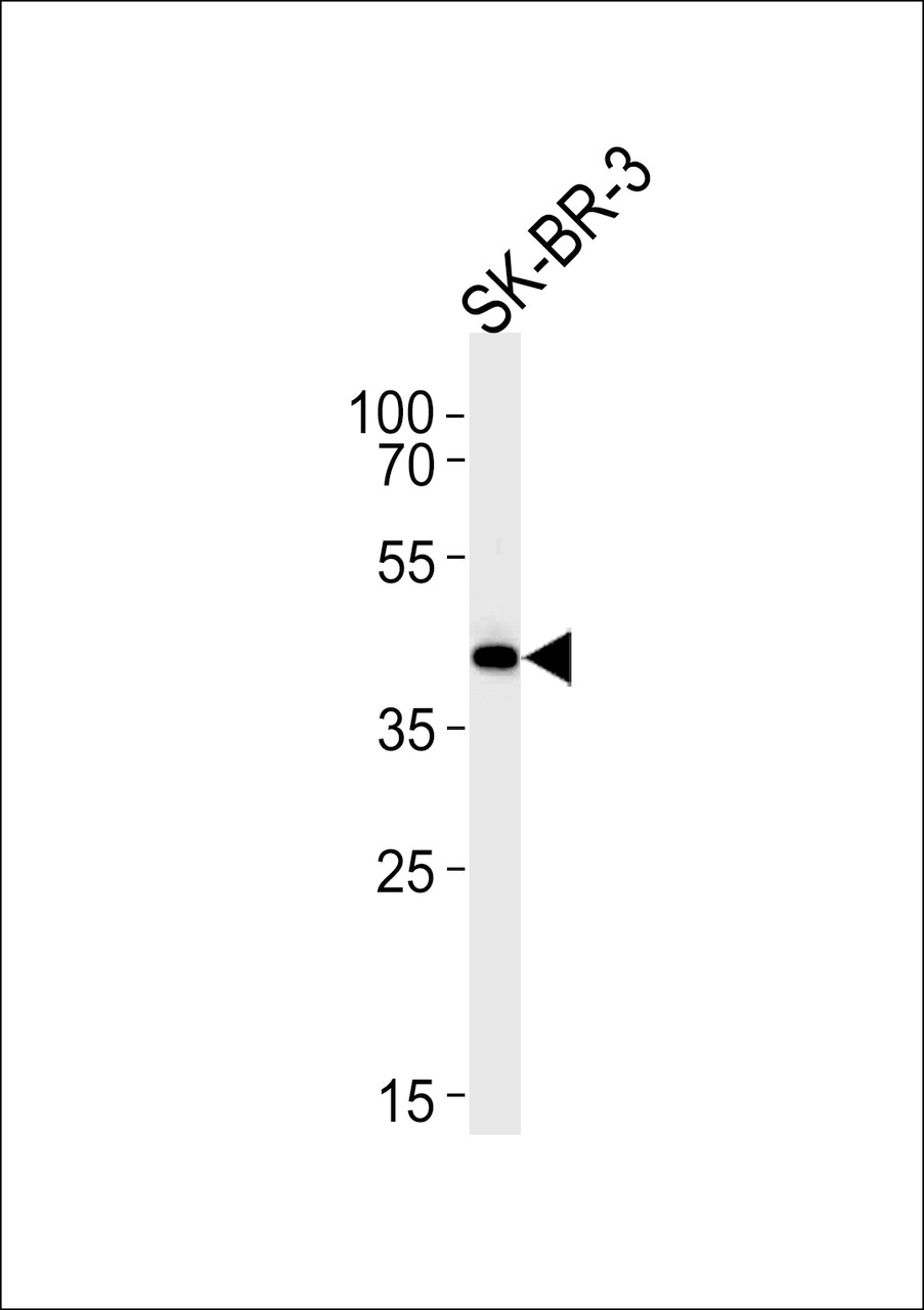 Western blot analysis in SK-BR-3 cell line lysates (35ug/lane) .