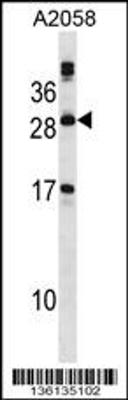 Western blot analysis in A2058 cell line lysates (35ug/lane) .