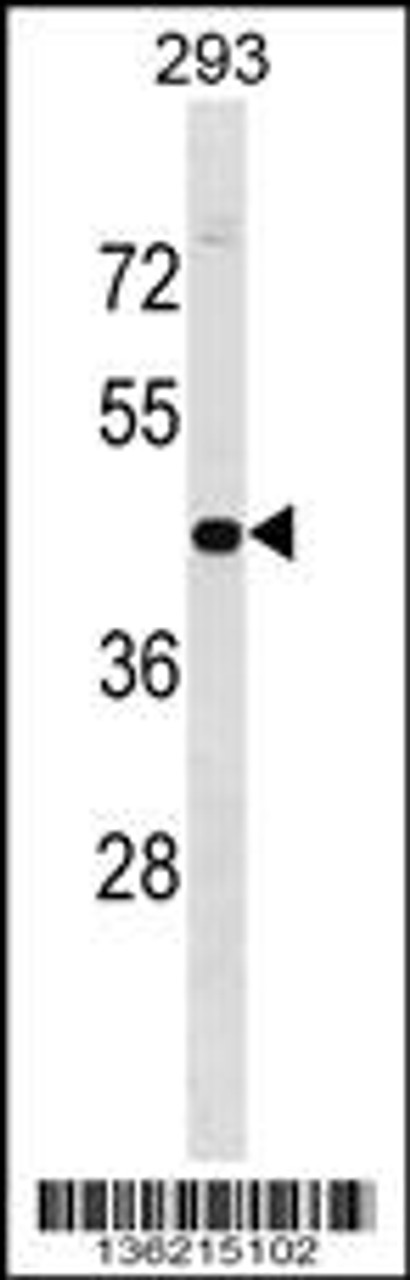 Western blot analysis in 293 cell line lysates (35ug/lane) .