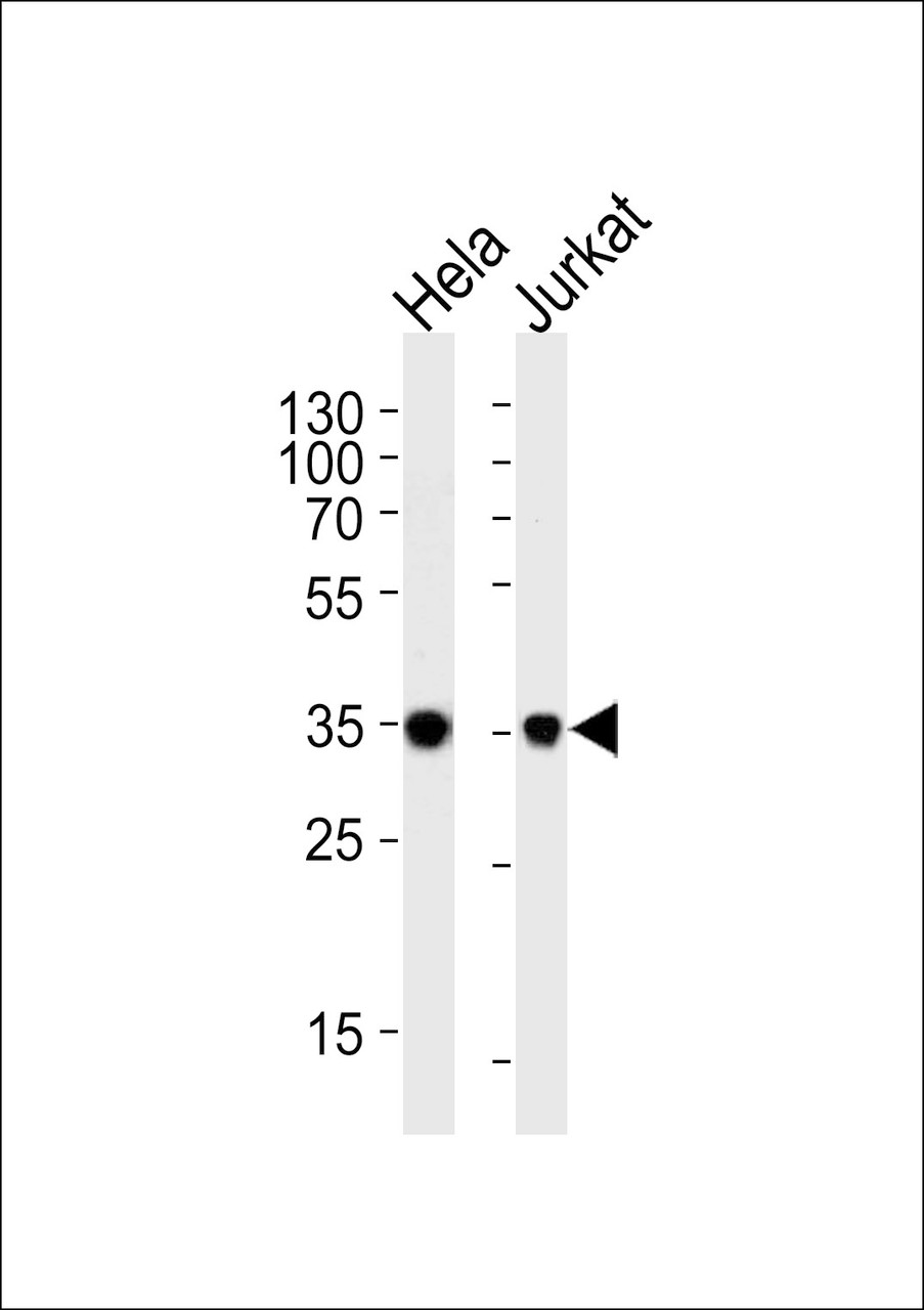 Western blot analysis of lysates from Hela, Jurkat cell line (from left to right) , using FRG1 Antibody at 1:1000 at each lane.