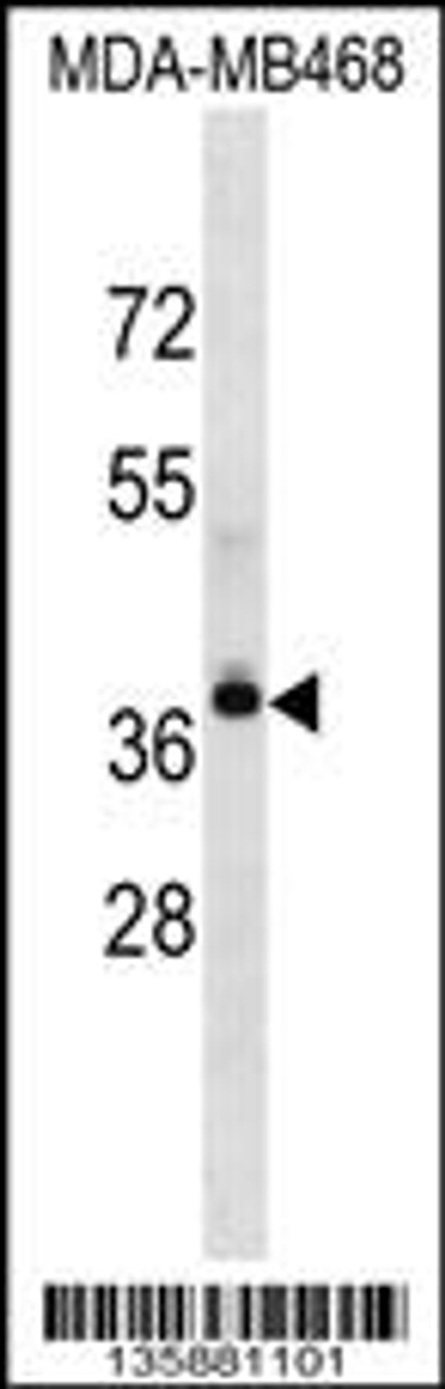 Western blot analysis in MDA-MB468 cell line lysates (35ug/lane) .