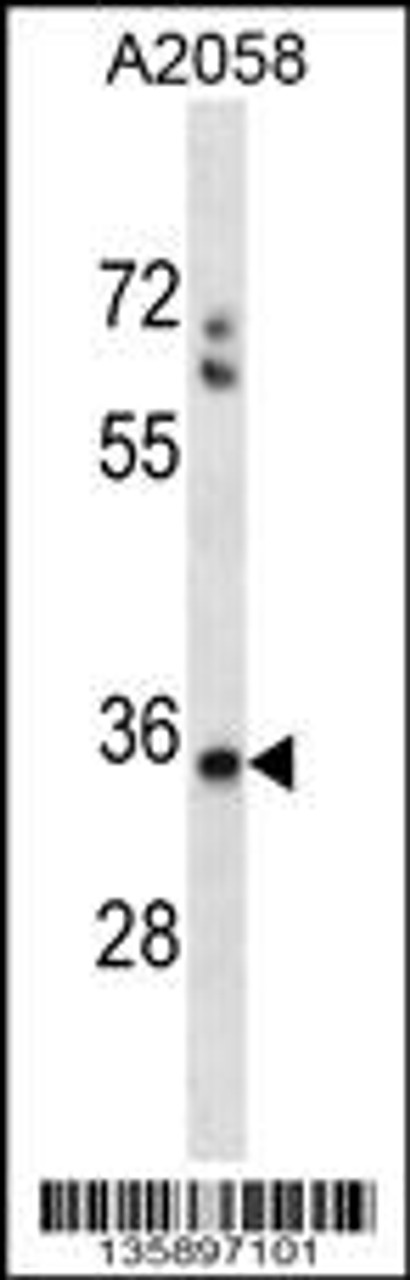 Western blot analysis in A2058 cell line lysates (35ug/lane) .