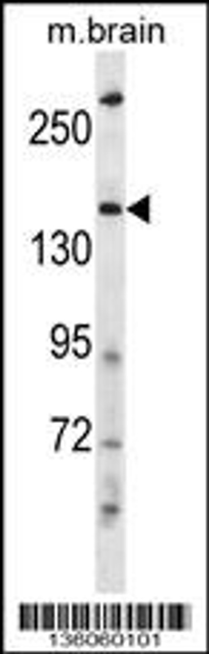 Western blot analysis in mouse brain tissue lysates (35ug/lane) .