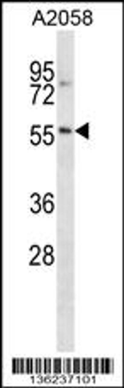 Western blot analysis in A2058 cell line lysates (35ug/lane) .