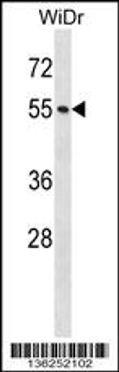 Western blot analysis in WiDr cell line lysates (35ug/lane) .