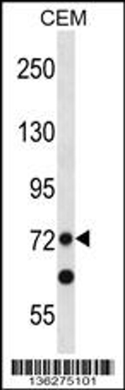 Western blot analysis in CEM cell line lysates (35ug/lane) .