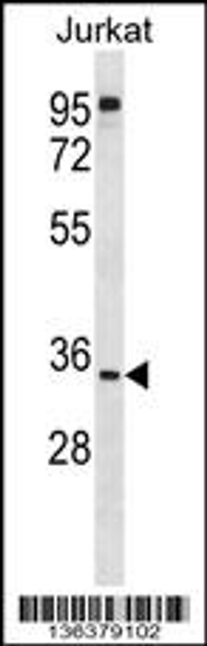 Western blot analysis in Jurkat cell line lysates (35ug/lane) .