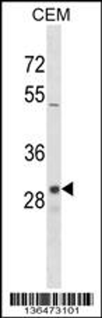 Western blot analysis in CEM cell line lysates (35ug/lane) .