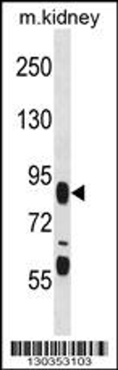 Western blot analysis in mouse kidney tissue lysates (35ug/lane) .