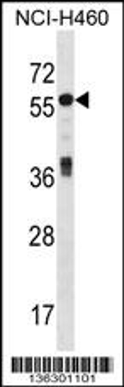 Western blot analysis in NCI-H460 cell line lysates (35ug/lane) .