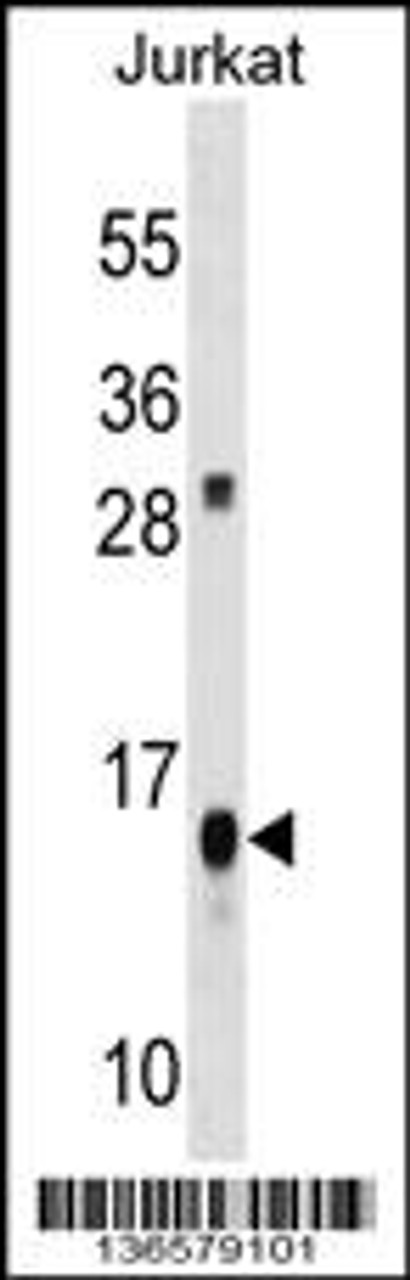 Western blot analysis in Jurkat cell line lysates (35ug/lane) .