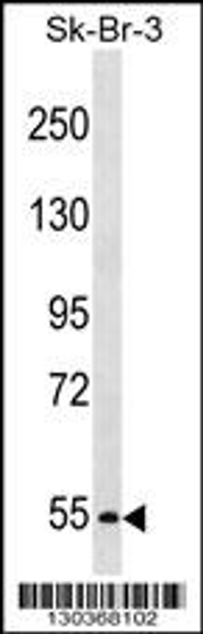 Western blot analysis in SK-BR-3 cell line lysates (35ug/lane) .