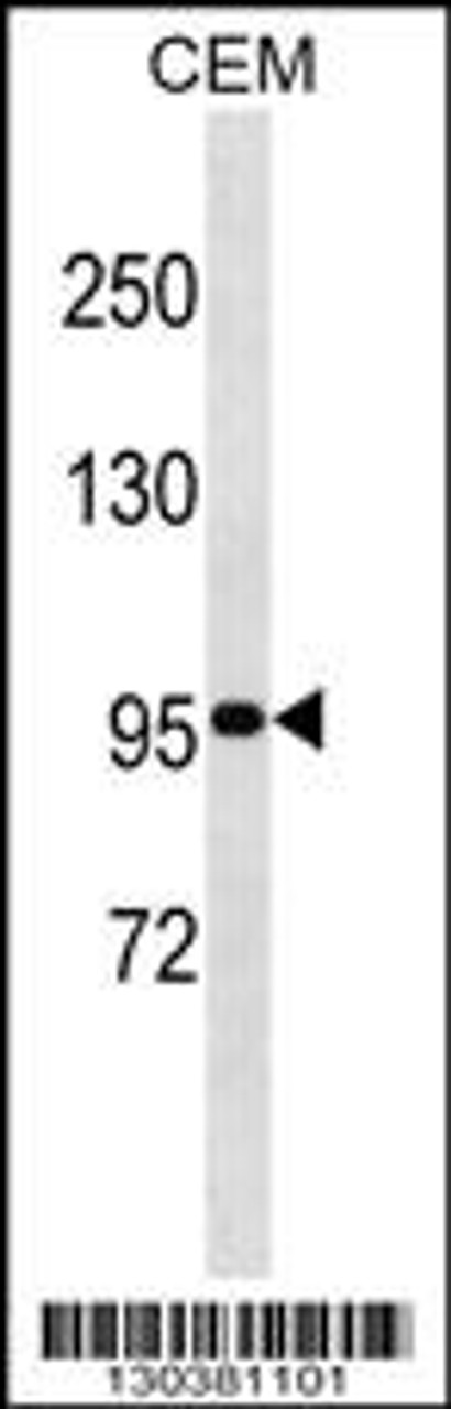 Western blot analysis in CEM cell line lysates (35ug/lane) .