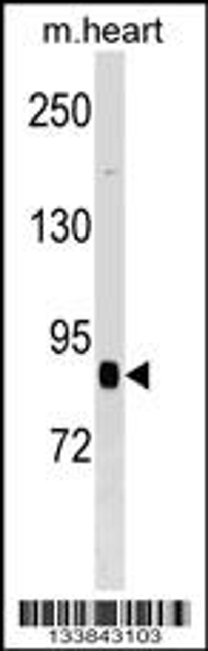 Western blot analysis in mouse heart tissue lysates (35ug/lane) .