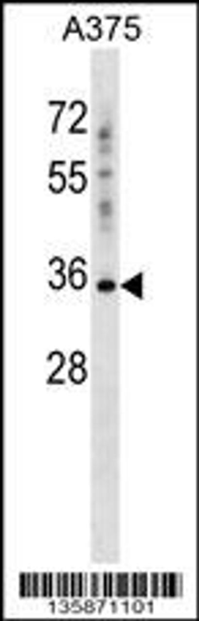 Western blot analysis in A375 cell line lysates (35ug/lane) .