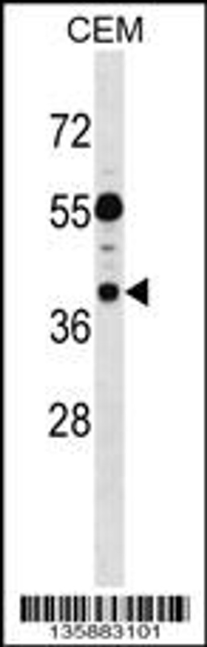 Western blot analysis in CEM cell line lysates (35ug/lane) .