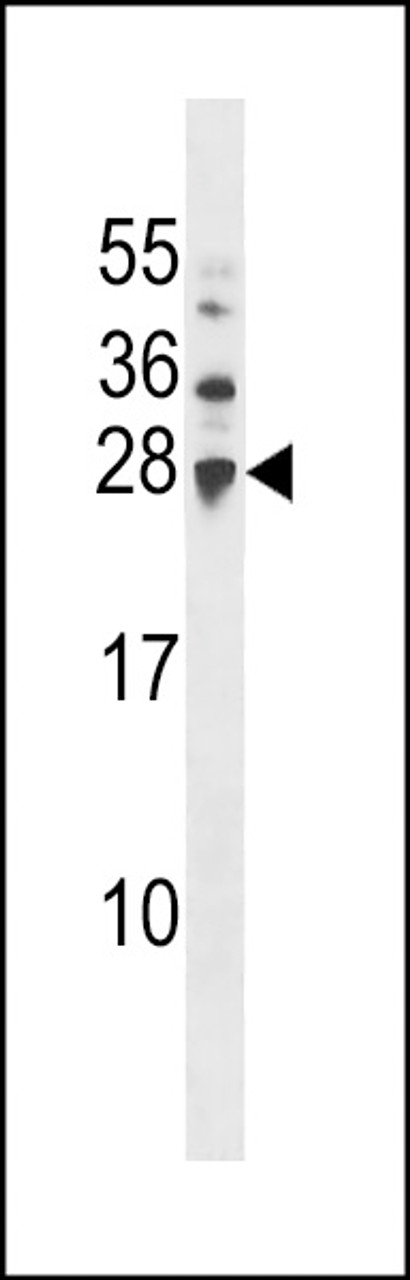 Western blot analysis in A2058 cell line lysates (35ug/lane) .