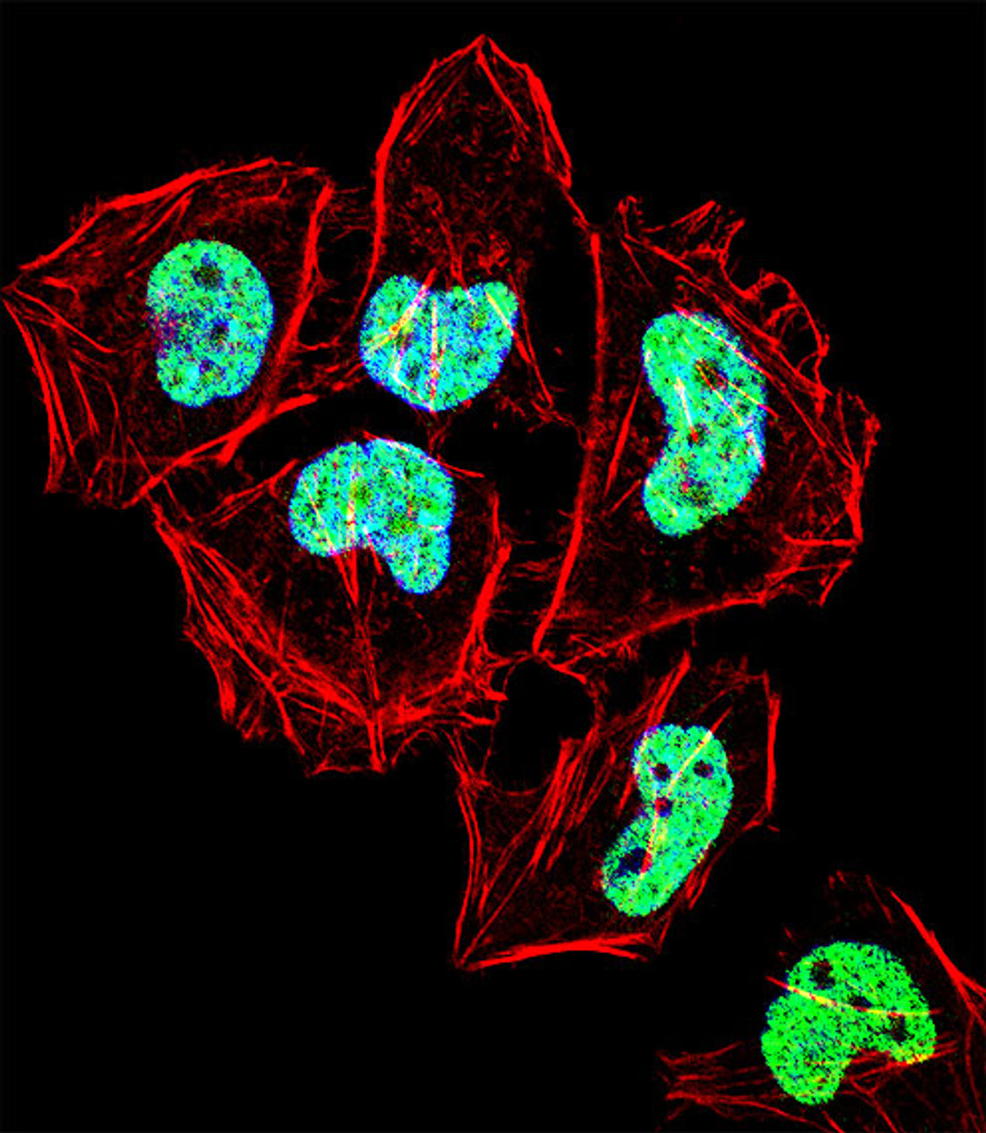 Fluorescent confocal image of Hela cell stained with ZNF155 Antibody .Hela cells were fixed with 4% PFA (20 min) , permeabilized with Triton X-100 (0.1%, 10 min) , then incubated with ZNF155 primary antibody (1:25) . For secondary antibody, Alexa Fluor 488 conjugated donkey anti-rabbit antibody (green) was used (1:400) .Cytoplasmic actin was counterstained with Alexa Fluor 555 (red) conjugated Phalloidin (7units/ml) . Nuclei were counterstained with DAPI (blue) (10 ug/ml, 10 min) . ZNF155 immunoreactivity is localized to Nucleus significantly.