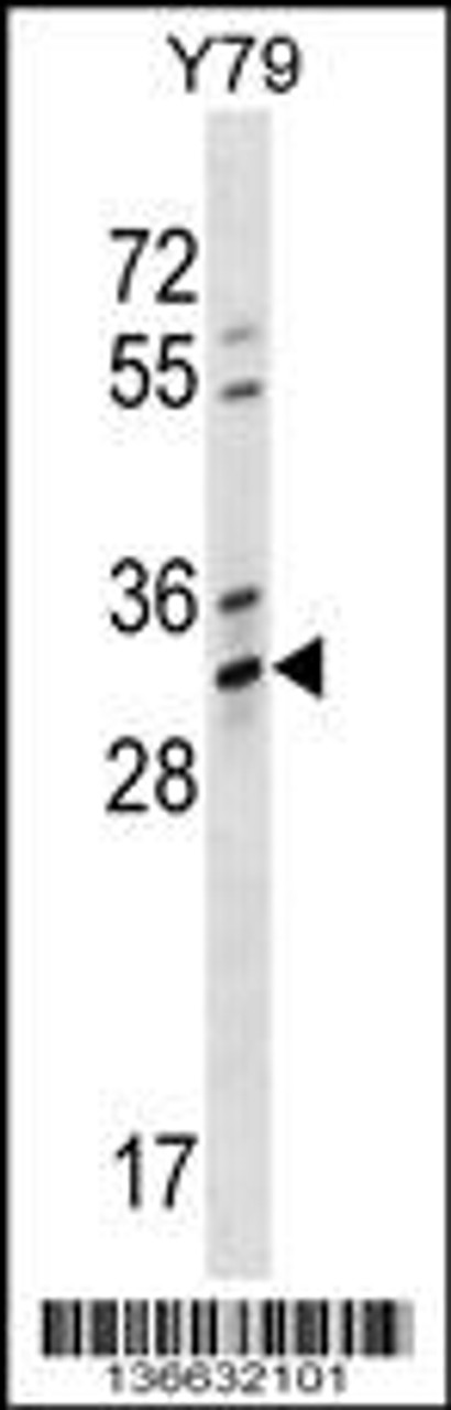 Western blot analysis in Y79 cell line lysates (35ug/lane) .