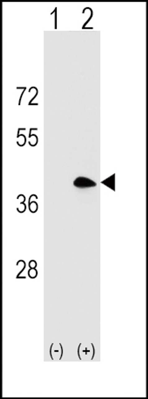 Western blot analysis of MS4A1 using rabbit polyclonal MS4A1 Antibody using 293 cell lysates (2 ug/lane) either nontransfected (Lane 1) or transiently transfected (Lane 2) with the MS4A1 gene.