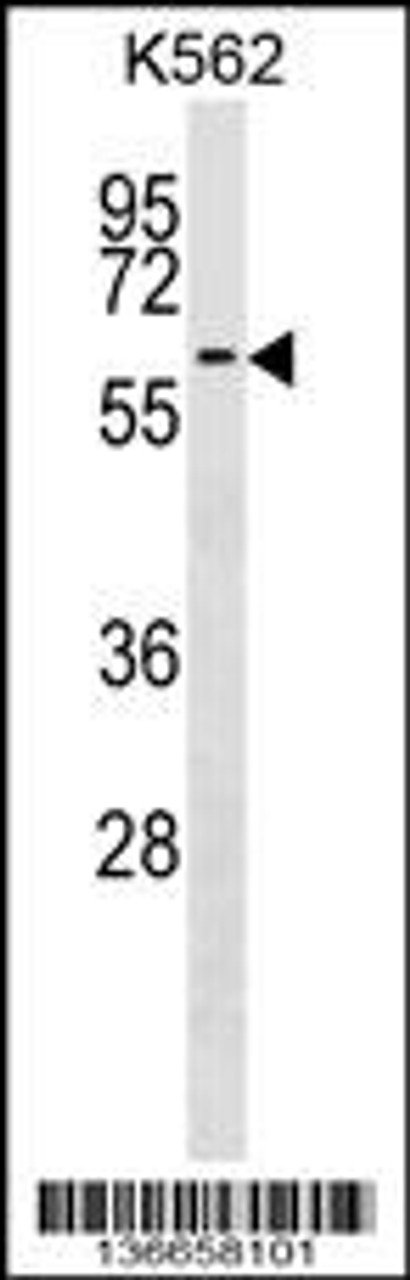 Western blot analysis in K562 cell line lysates (35ug/lane) .This demonstrates the detected the F9 protein (arrow) .