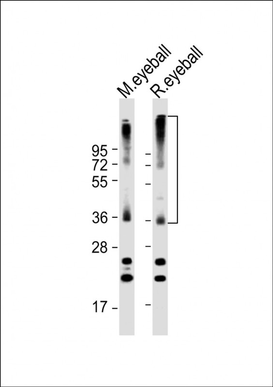 Western Blot at 1:2000 dilution Lane 1: mouse eyeball lysate Lane 2: rat eyeball lysate Lysates/proteins at 20 ug per lane.