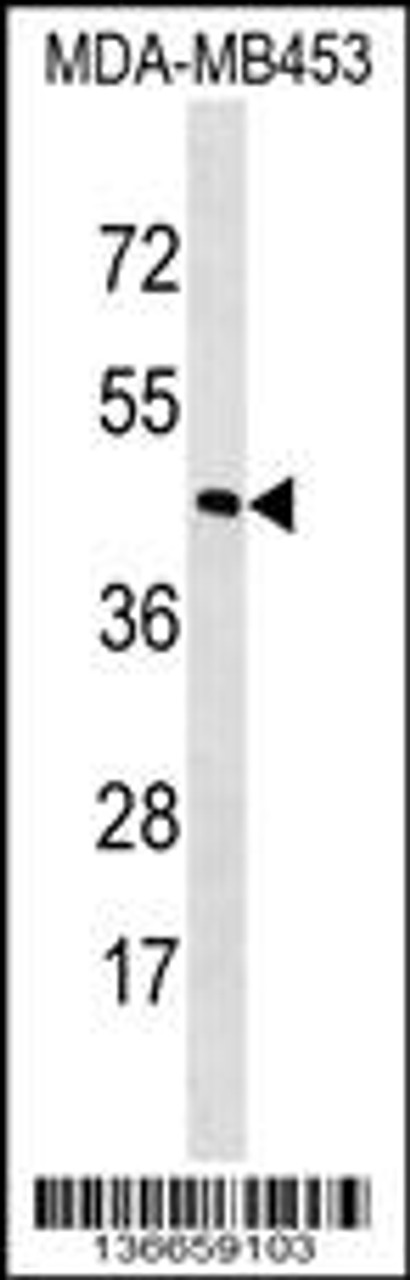 Western blot analysis in MDA-MB453 cell line lysates (35ug/lane) .