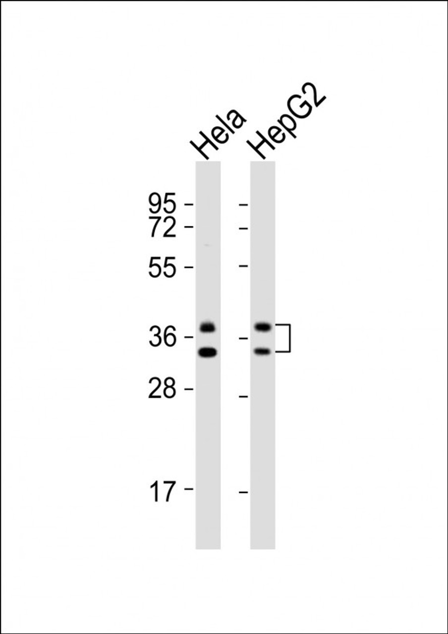 Western Blot at 1:1000 dilution Lane 1: Hela whole cell lysates Lane 2: HepG2 whole cell lysates Lysates/proteins at 20 ug per lane.