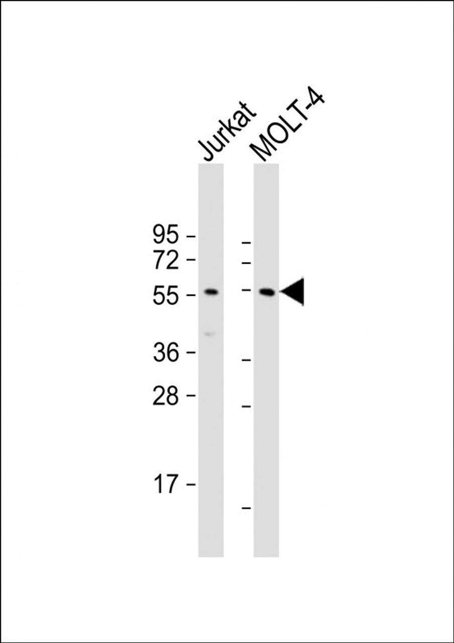 Western Blot at 1:1000 dilution Lane 1: Jurkat whole cell lysate Lane 2: MOLT-4 whole cell lysate Lysates/proteins at 20 ug per lane.