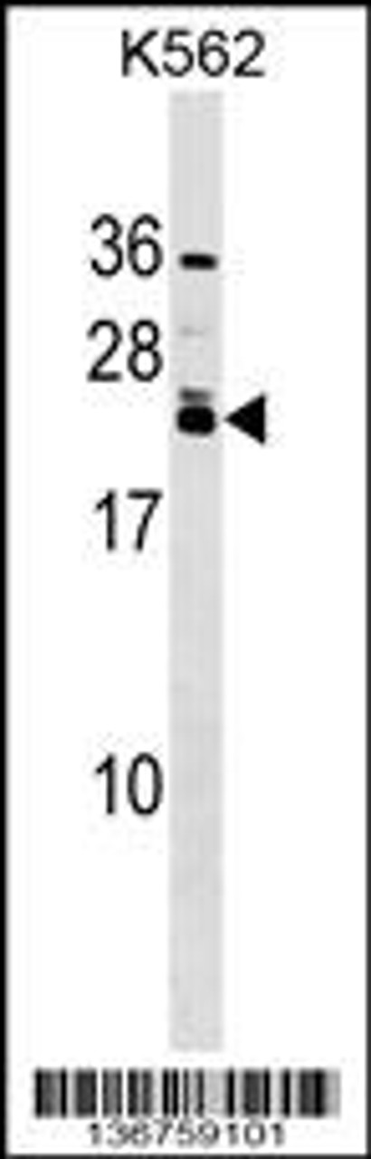 Western blot analysis in K562 cell line lysates (35ug/lane) .