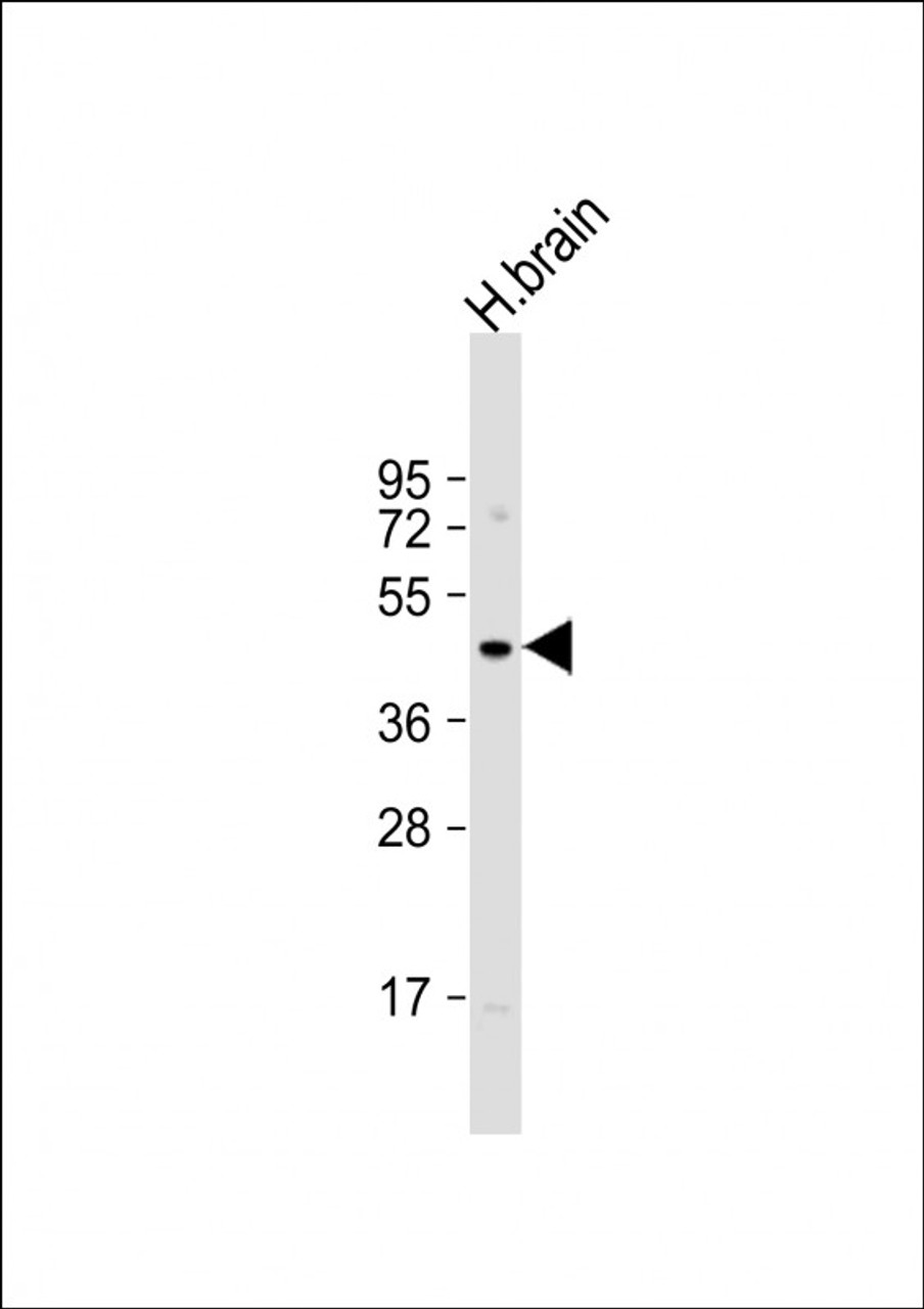 Western Blot at 1:1000 dilution + human brain lysate Lysates/proteins at 20 ug per lane.