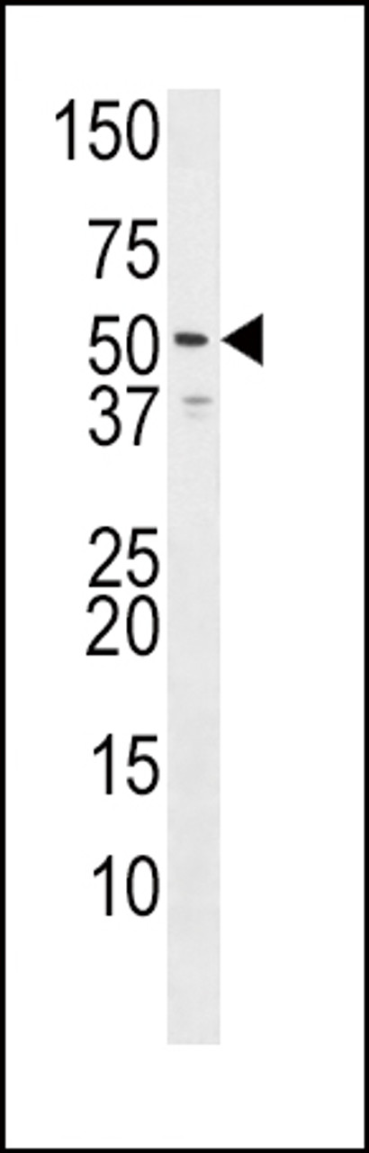 Western blot analysis in Jurkat cell line lysate (35ug/lane) . HH3R (arrow) was detected using the purified Pab. This Western blot identifies isoform two of HRH3. The accession number of HRH3 is CAC39434; Q9Y5N1.