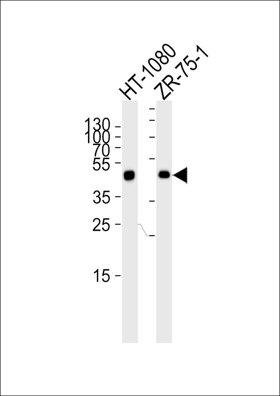 Western blot analysis of lysates from HT-1080, ZR-75-1 cell line (from left to right) , using CRTAP Antibody at 1:1000 at each lane.