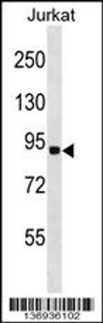 Western blot analysis in Jurkat cell line lysates (35ug/lane) .