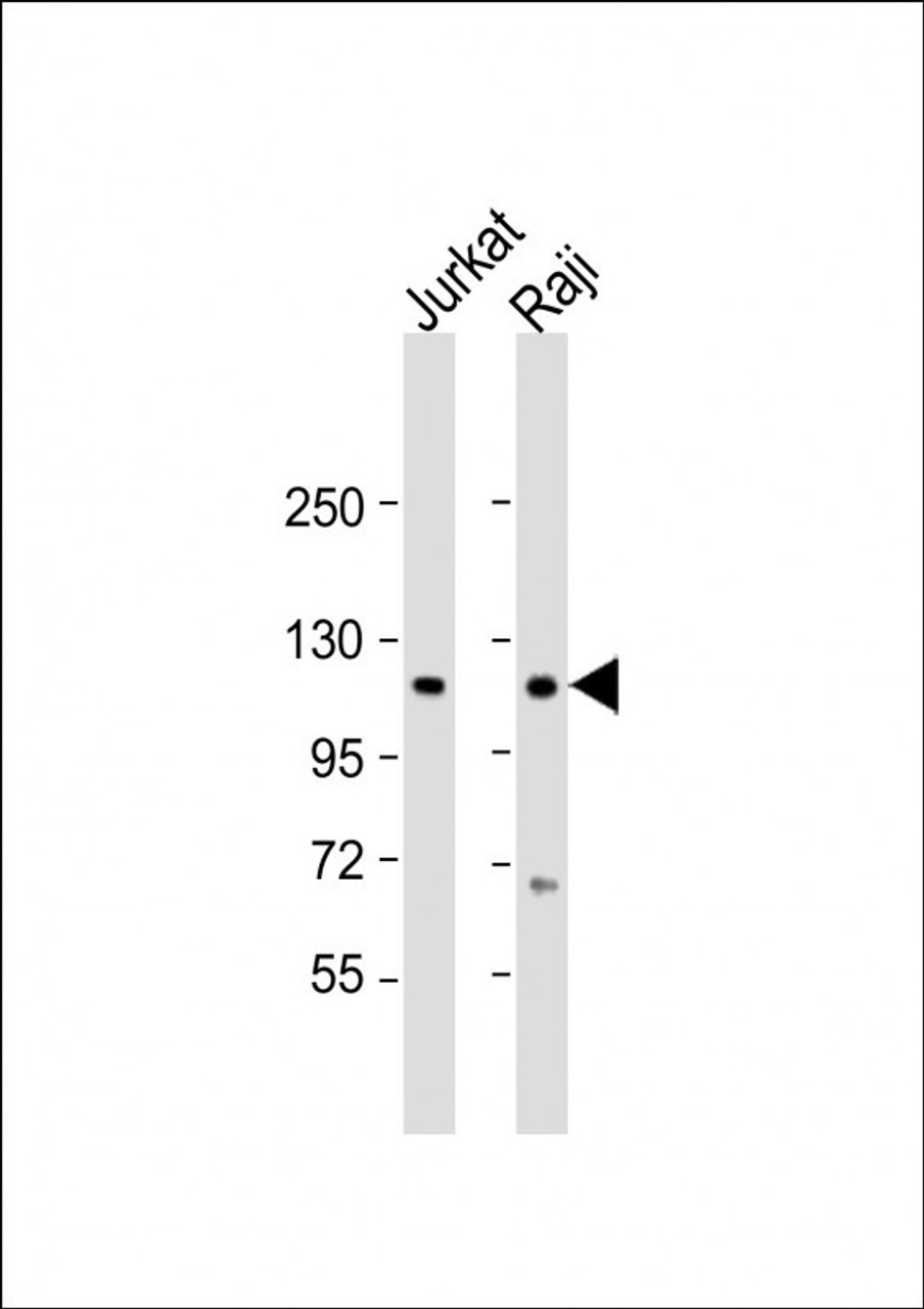 Western Blot at 1:2000 dilution Lane 1: Jurkat whole cell lysate Lane 2: Raji whole cell lysate Lysates/proteins at 20 ug per lane.
