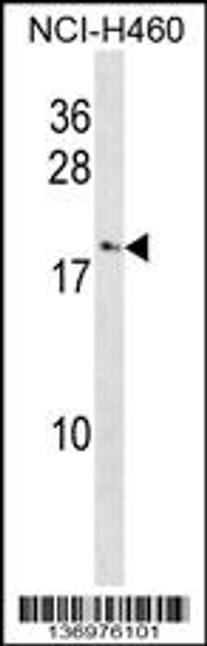 Western blot analysis in NCI-H460 cell line lysates (35ug/lane) .