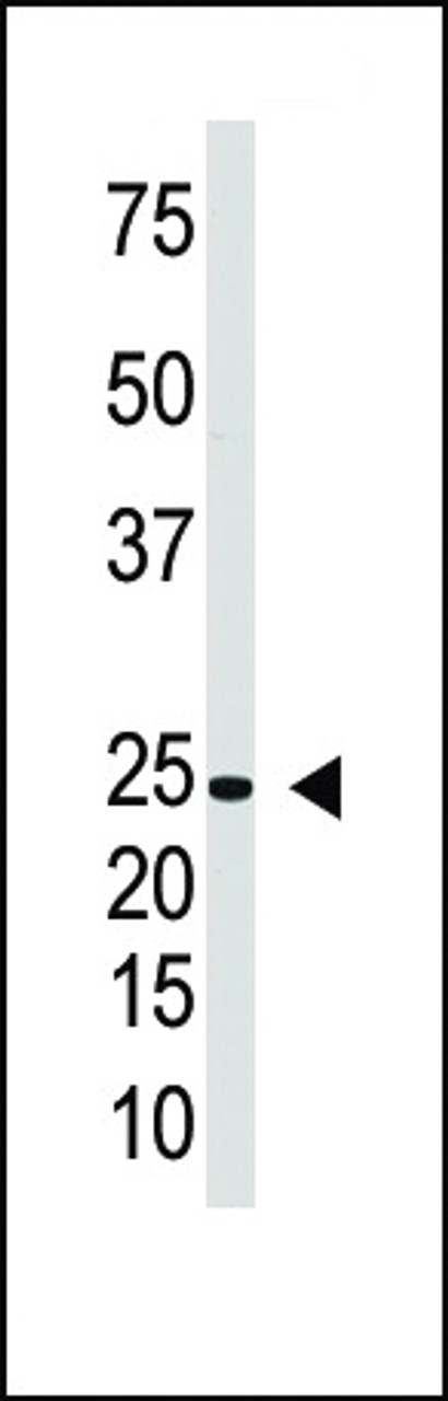 Antibody is used in Western blot to detect IL29 in Jurkat cell lysate.