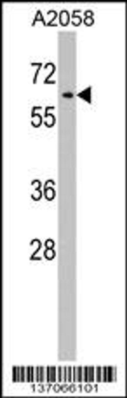 Western blot analysis in A2058 cell line lysates (35ug/lane) .