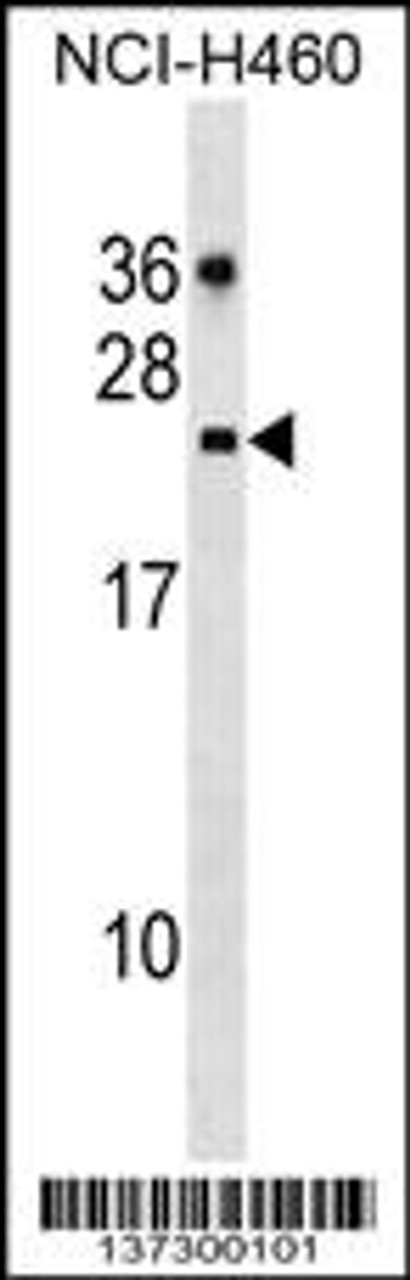 Western blot analysis in NCI-H460 cell line lysates (35ug/lane) .