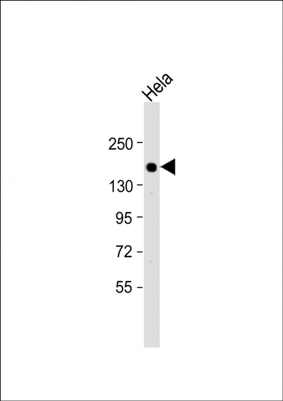 Western Blot at 1:1000 dilution + Hela whole cell lysate Lysates/proteins at 20 ug per lane.