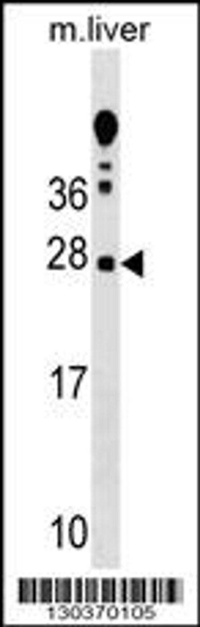 Western blot analysis in mouse liver tissue lysates (35ug/lane) .