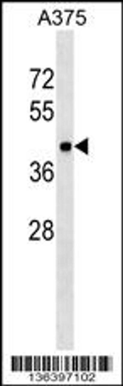 Western blot analysis in A375 cell line lysates (35ug/lane) .